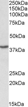 CSF1R Antibody