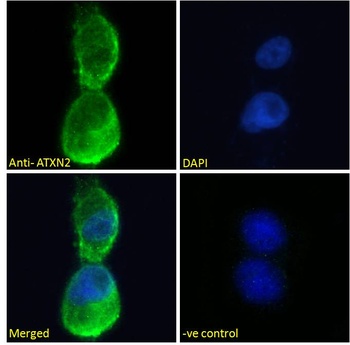 LY6E Antibody