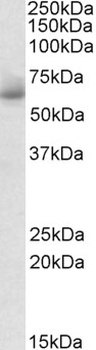 GRM2 Antibody