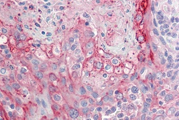 GRM2 Antibody
