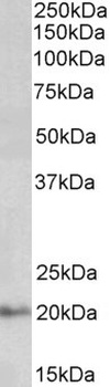 ETFA Antibody