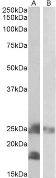 ETFA Antibody