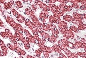 ALDH9A1 Antibody