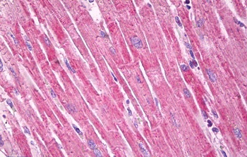 PLA2G4A Antibody