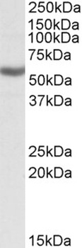 IGF2BP1 Antibody