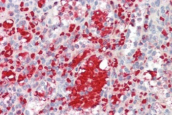 POU4F3 Antibody