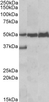 TRIP6 Antibody