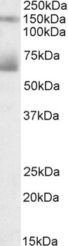 TRIM71 Antibody