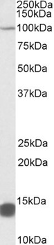 HSH2D Antibody
