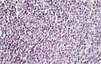 AIM2 Antibody