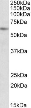 ACADVL Antibody