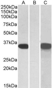 ACO2 Antibody