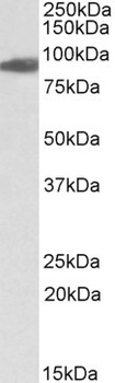GLUD1 / GLUD2 Antibody