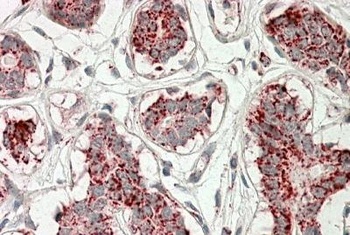 GLUD1 / GLUD2 Antibody