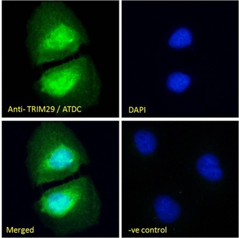 CRISP2 Antibody