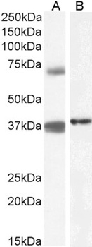 LAIR1 Antibody