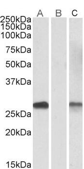 CHCHD3 Antibody