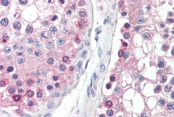 CHCHD3 Antibody