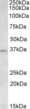 HOXD13 Antibody