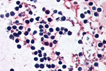 TOMM40 Antibody