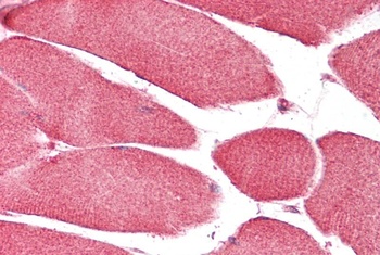 PDE1A Antibody