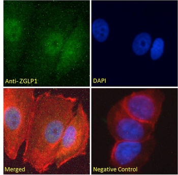 PAX4 Antibody