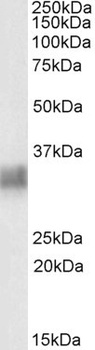 SLC12A2 Antibody
