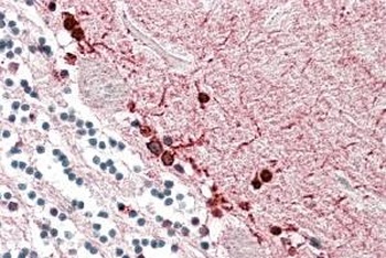 ATP1B1 Antibody