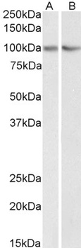 TERF2IP Antibody