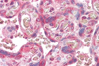 PCSK9 Antibody