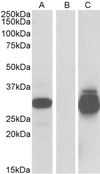 MOBKL3 Antibody
