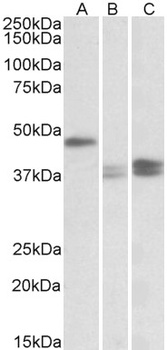 EPM2AIP1 Antibody