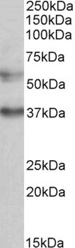 RORC Antibody