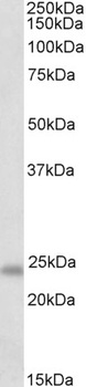 PKP2 Antibody