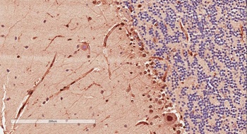 GNAQ Antibody