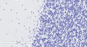 GNAQ Antibody