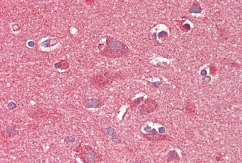 GM2A Antibody