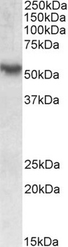 DCX Antibody