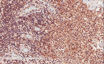 Crot Antibody