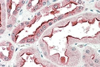 CD28 Antibody