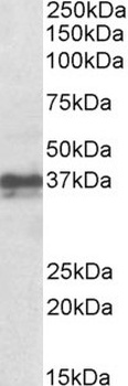 CD28 Antibody