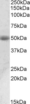 TXNDC11 Antibody