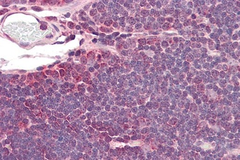 NFASC Antibody