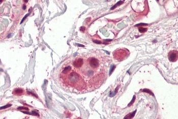 CHRNA5 Antibody