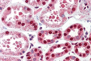 Sirt3 Antibody
