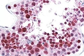 SOD2 Antibody