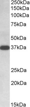 IDH3B Antibody