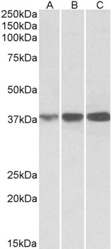 IDH3B Antibody