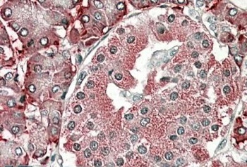 TXNDC5 Antibody