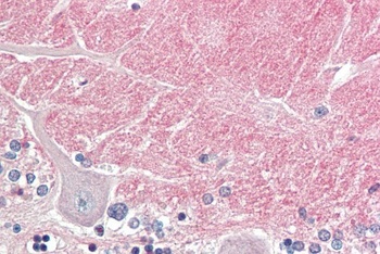HDAC6 Antibody